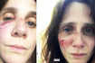 These shocking pictures of French actress Judith Chemla’s bruised face leave her fans worried