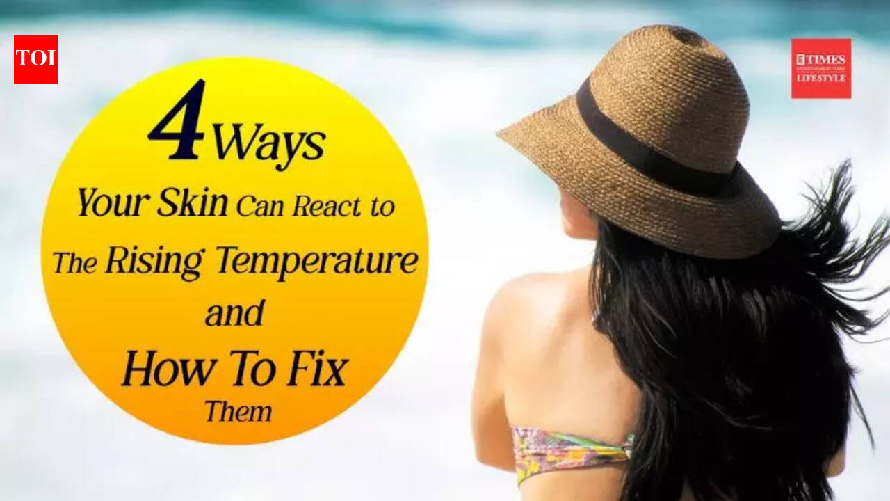 4 Ways your skin can react to the rising temperature and how to fix them
