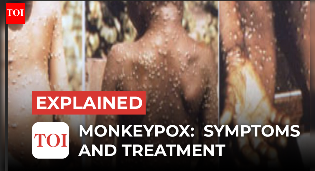 monkeypox: Monkeypox first case in India: What are the symptoms and is ...
