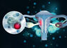 Sexually transmitted infection (STI) that could cause cervical cancer