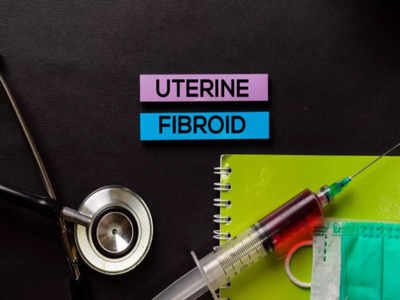 Dispelling myths related to uterine fibroids