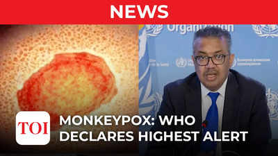 WHO declares monkeypox a global health emergency as infections soar