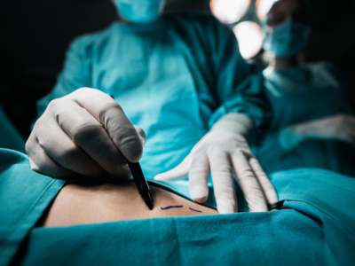Liposuction and other types of weight loss surgeries
