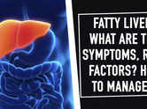 Fatty liver: What are the symptoms, risk factors? How to manage it