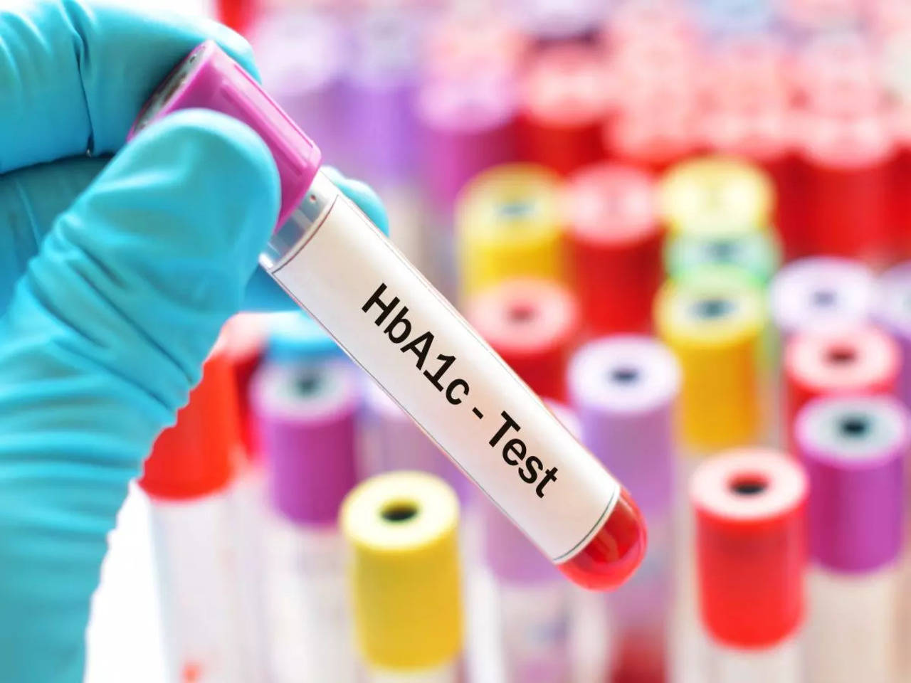 Importance of HbA1c in diabetes monitoring - Times of India