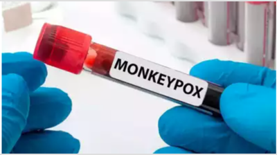 Two Delhi-NCR patients under monkeypox watch test negative
