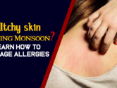 Itchy skin during monsoon- Learn how to manage allergies