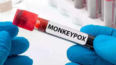 Aurangabad man's sample sent for monkeypox test
