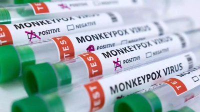 Bihar: Aurangabad man tests negative for monkeypox