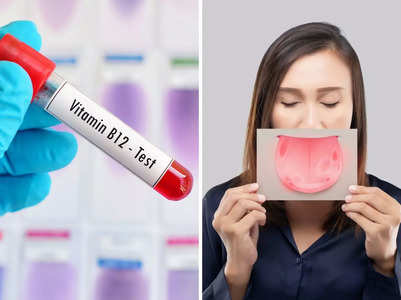 Vitamin B12 deficiency: Symptoms on your tongue