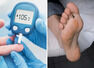 7 diabetes symptoms in your feet