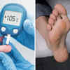 Understanding Diabetes Swollen Feet and Legs