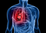 Heart disease: THIS sign in limbs might be an indicator