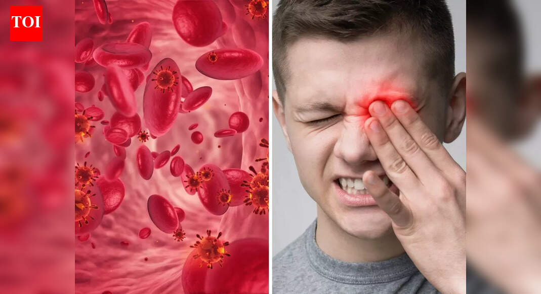Iron Deficiency Symptoms: Do NOT overlook the sign inside your lower eyelid