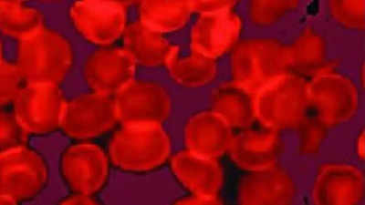 IISc scientists help develop point-of-care, low-cost test for Sickle Cell Anaemia