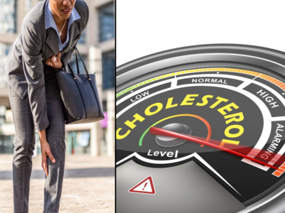 High cholesterol sign to not ignore when walking