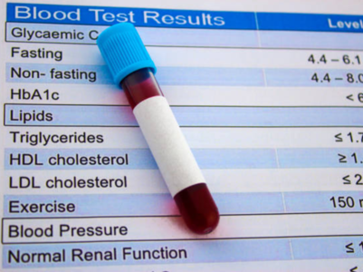 What is the right age to start monitoring blood cholesterol?