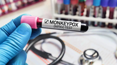 Delhi records sixth monkeypox case as African tests positive