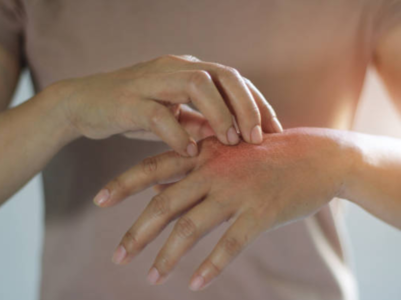 These common skin issues might be due to COVID
