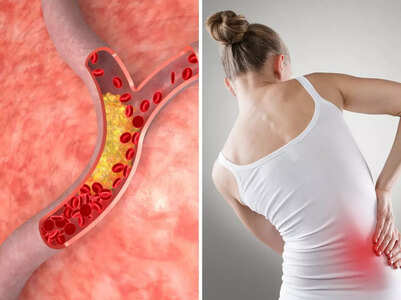 Sign of high cholesterol in 3 areas of the body