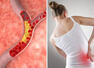 Sign of high cholesterol in 3 areas of the body