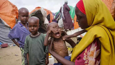 Somalia: Around 730 children dead in Somalia nutrition centres: UN ...