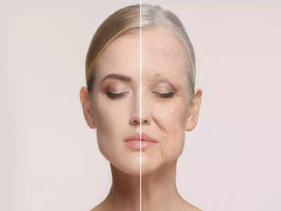 Don’t wait till you get wrinkles, start treating them beforehand
