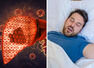 Fatty liver: Your sleeping habits can determine your risk 