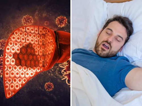 Liver health and the importance of sleep