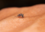 Recurrent dengue increases risk of complication by 50%, says expert and stresses on IgG test