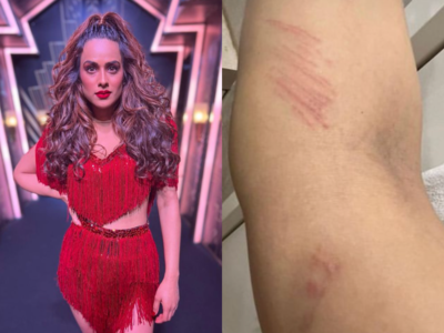 Nia Sharma gets injured while rehearsing her dance routine for Jhalak Dikhhla Jaa 10; see pic
