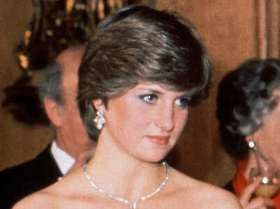 Did you know Princess Diana suffered from Rosacea?