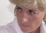 Did you know Princess Diana suffered from Rosacea?