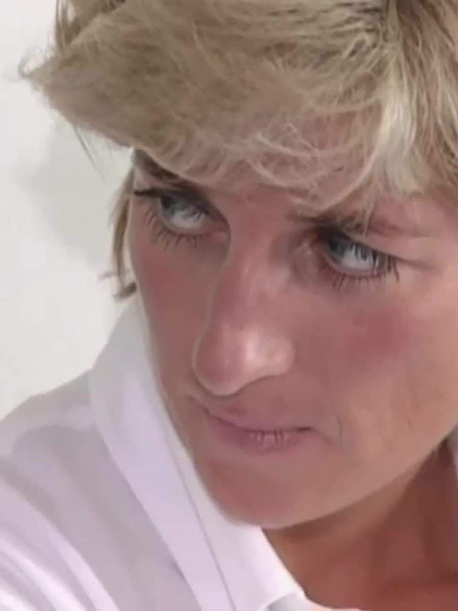 Did you know Princess Diana suffered from Rosacea?