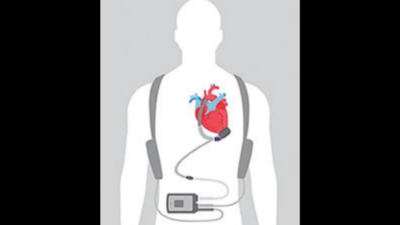 Made-in-India ‘artificial heart’ to be 8 times cheaper than imported one