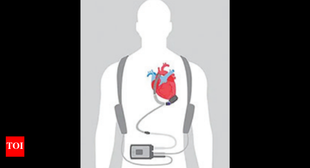 MadeinIndia ‘artificial heart’ to be 8 times cheaper than imported