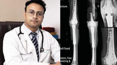 Nagpur: Doctors save cancer survivor’s limb, turn him into ‘Ironman’