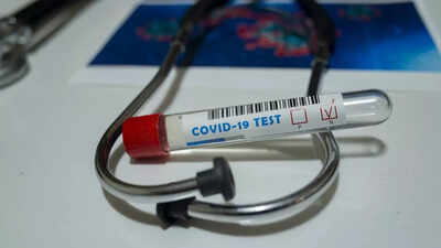 Tamil Nadu logs 522 new cases of Covid