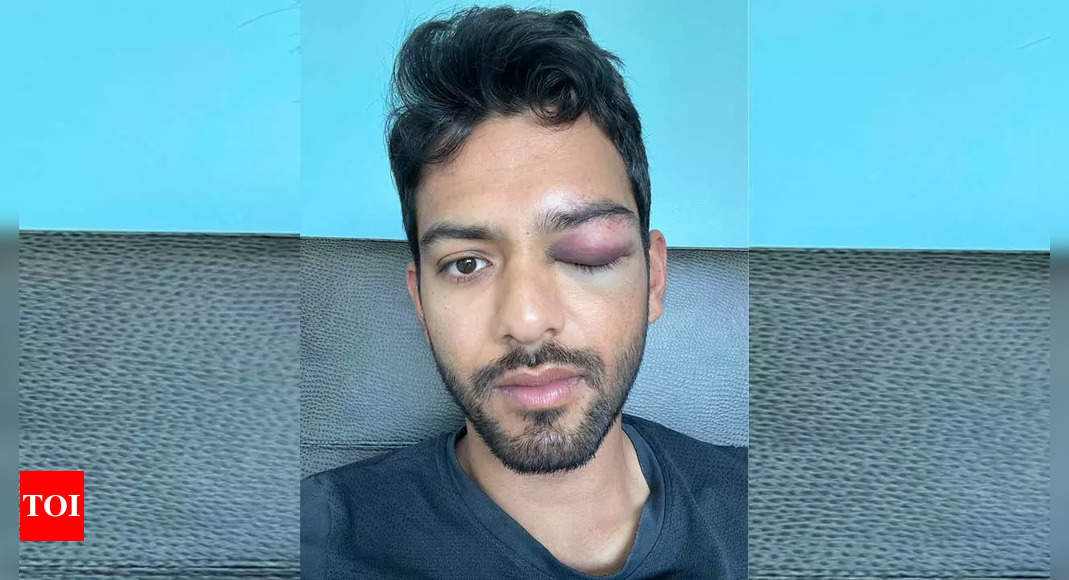 Former India U-19 star Unmukt Chand suffers serious eye injury; says grateful to have survived a possible disaster | Cricket News – Times of India