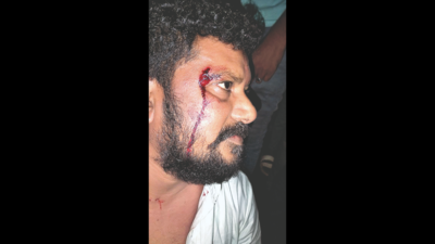 Gujarat: Vansda Congress MLA attacked in Khergam