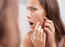Tackle pre-wedding breakouts with these handy tips