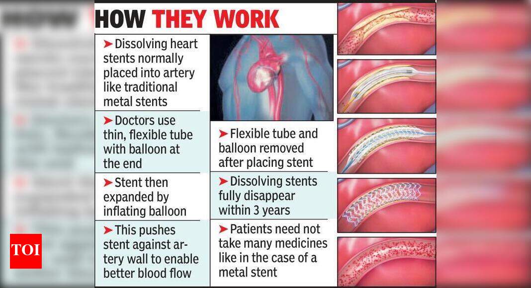Use Of Dissolving Heart Stents Now Becoming Commonplace Nagpur News 