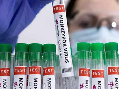 Mysuru: Monkeypox-like symptoms found in girl
