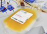 Dengue patient given mosambi juice in drip!