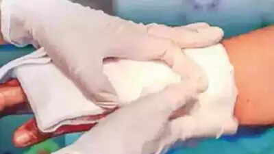 Jharkhand: Rajendra Institute of Medical Sciences on alert for possible rise in burn cases