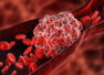 Study links COVID with death due to blood clots
