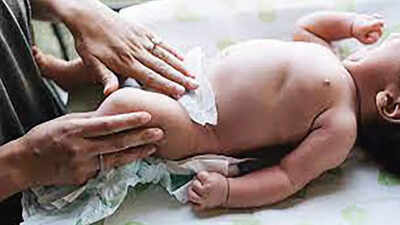 Nagpur doctor completes 4 decades of fixing congenital penile defect in newborns