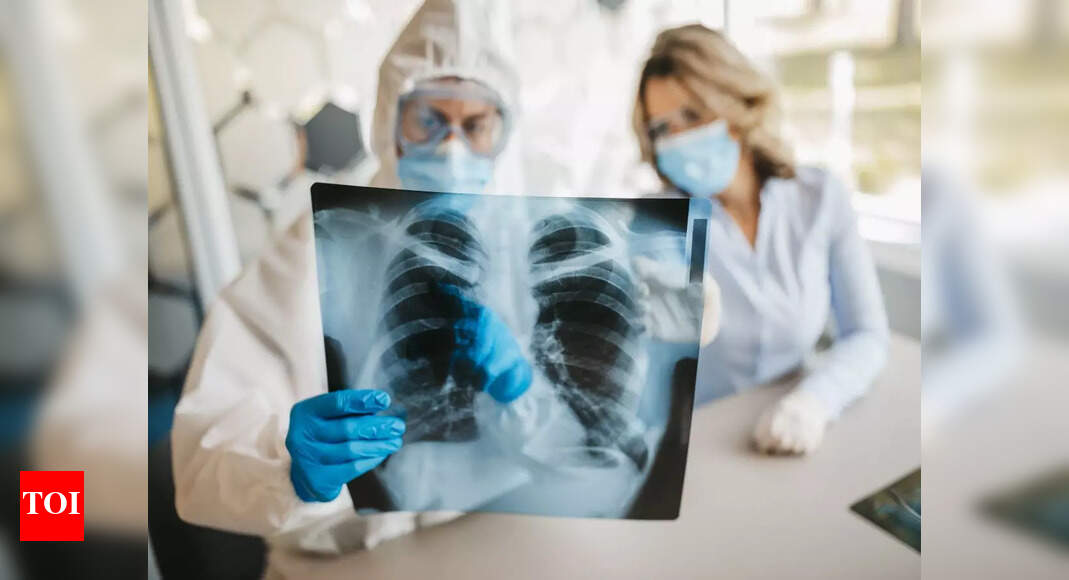 Coronavirus Researchers detect long COVID’s impact on lungs using