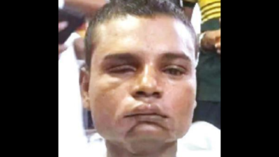 Kanpur: Bihar man blinded, forced into begging escapes from gang
