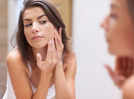
Cosmetic ingredients that cause acne
